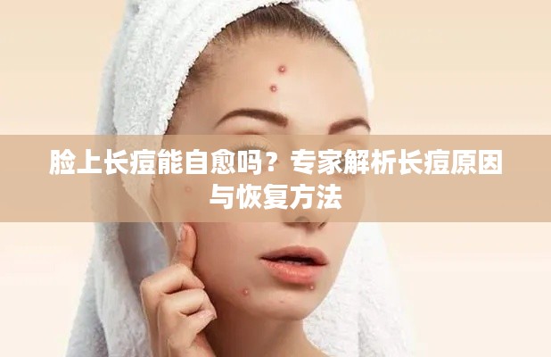 脸上长痘能自愈吗?专家解析长痘原因与恢复方法